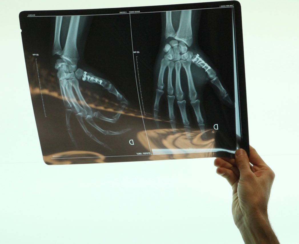 Lecture d'une radiographie du poignet — diagnostic spécialisé